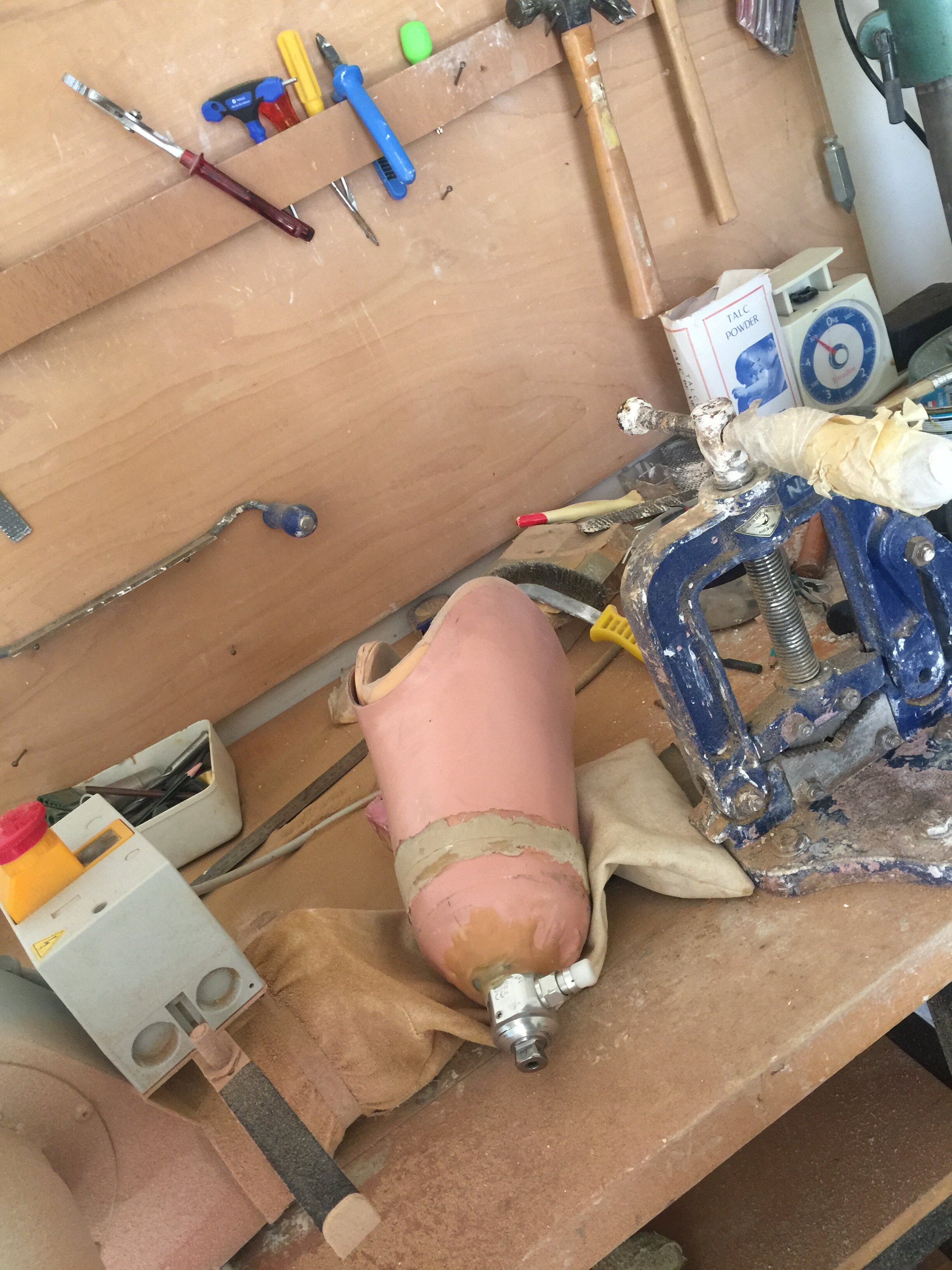 Beneficiary_Prosthesis.JPG